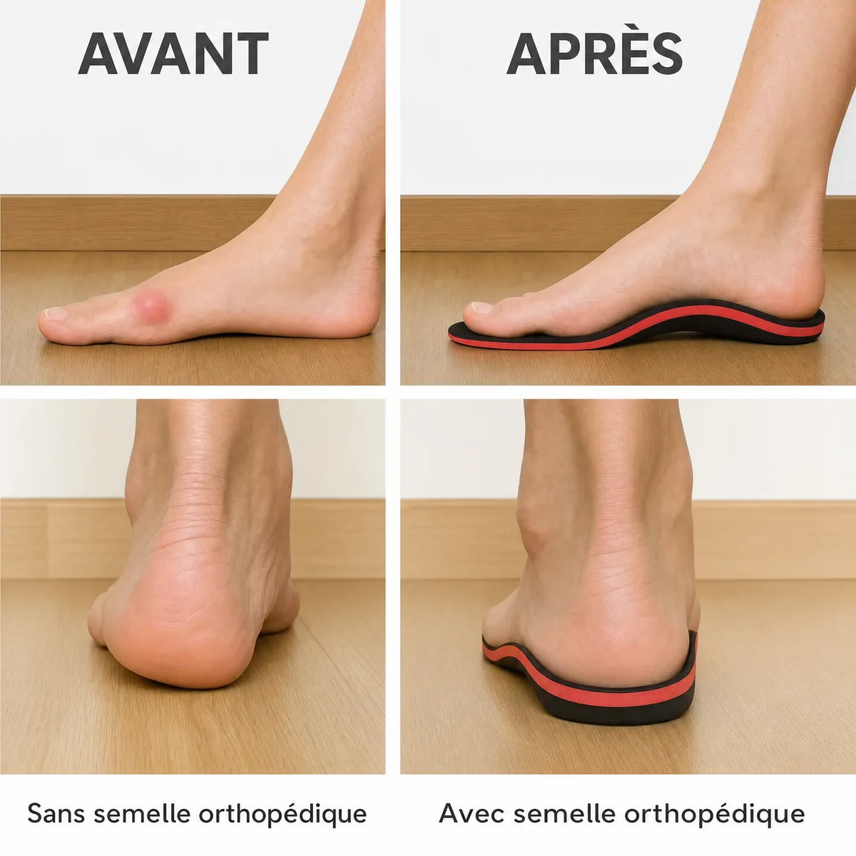 Opalmo-Semelle Orthopédique